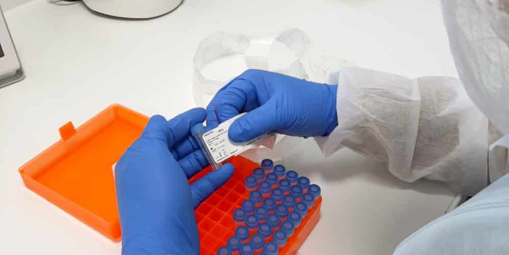 BioMérieux a la capacité de fabriquer 12 millions de tests sérologiques dans son usine de Marcy l’Etoile, près de Lyon
