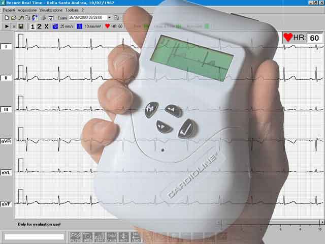 PAPIER ECG ET MEDICAL