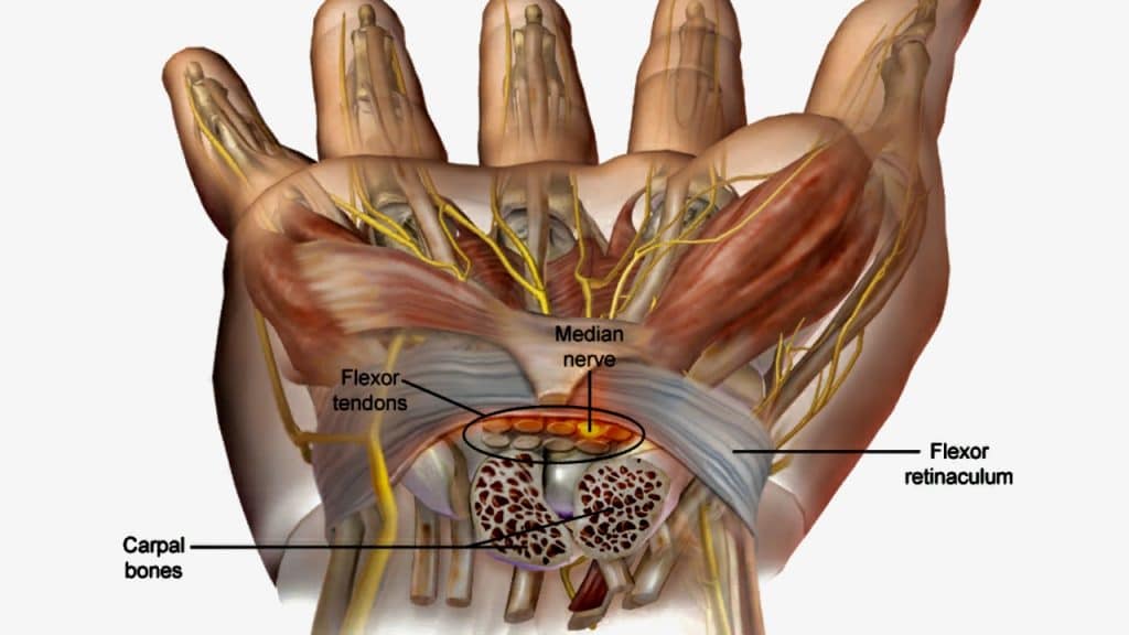 Traitement médical du canal carpien avec la MAGNOMEGA-THERAPIE®